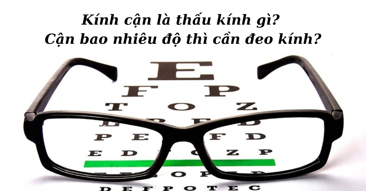 Kính Cận Là Thấu Kính Gì